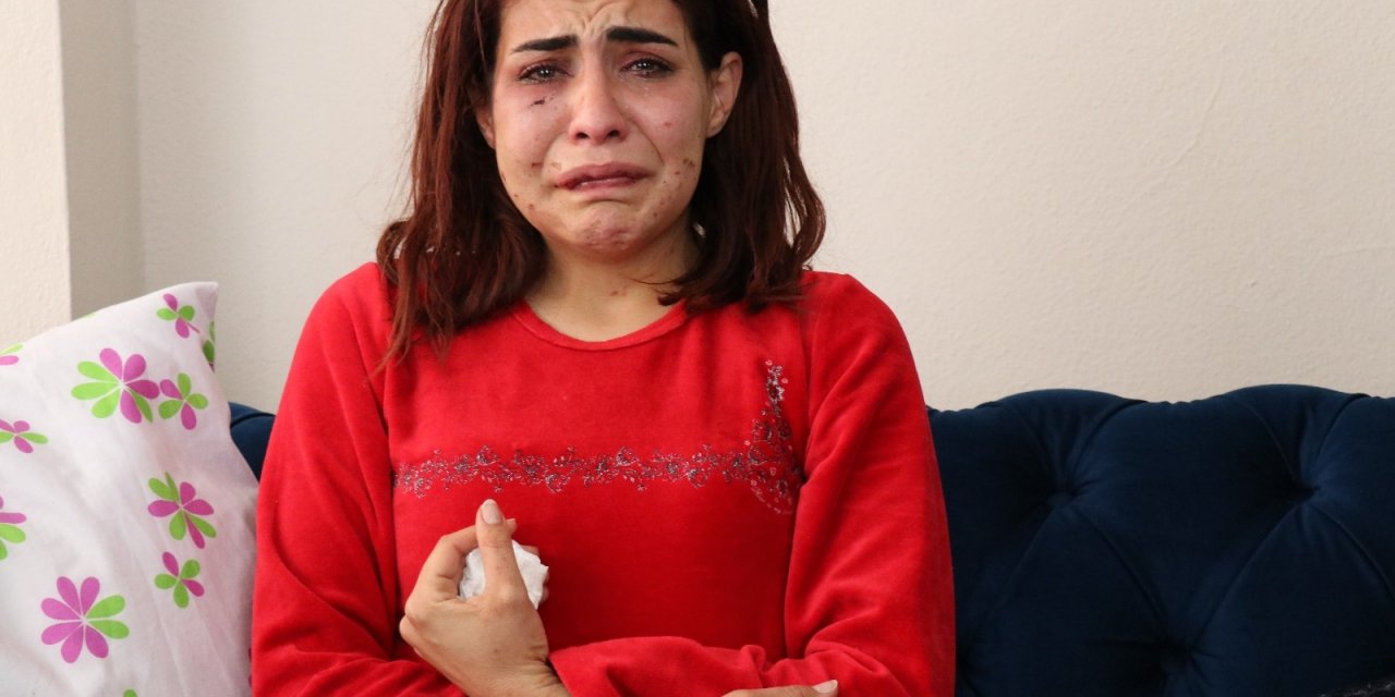 Sevgilisi Tarafından Darp Edilen Beyza: “başkaları Gibi Ölmek İstemiyorum”