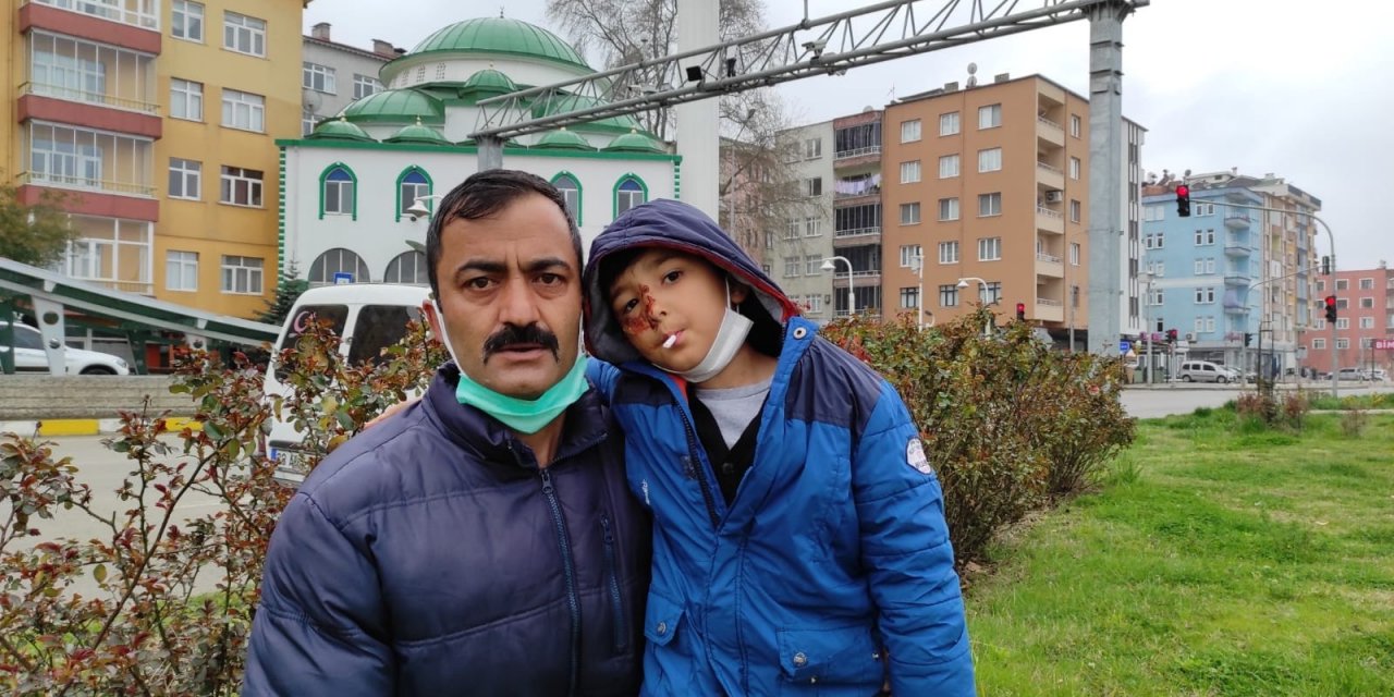 Sokak Köpeklerinin Saldırısına Uğrayan Çocuk Ölümden Kurtuldu