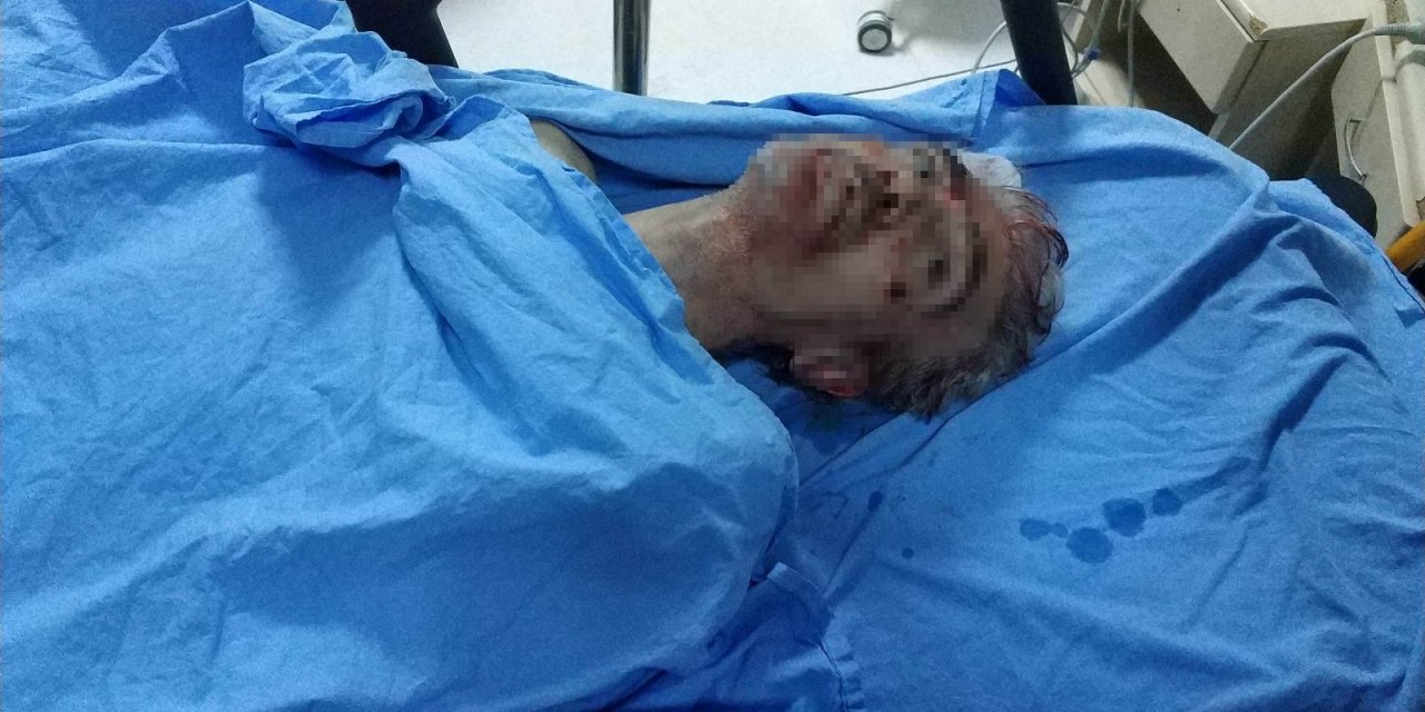 Samsun’daki Silahlı Saldırıda Ölü Sayısı 2’ye Çıktı