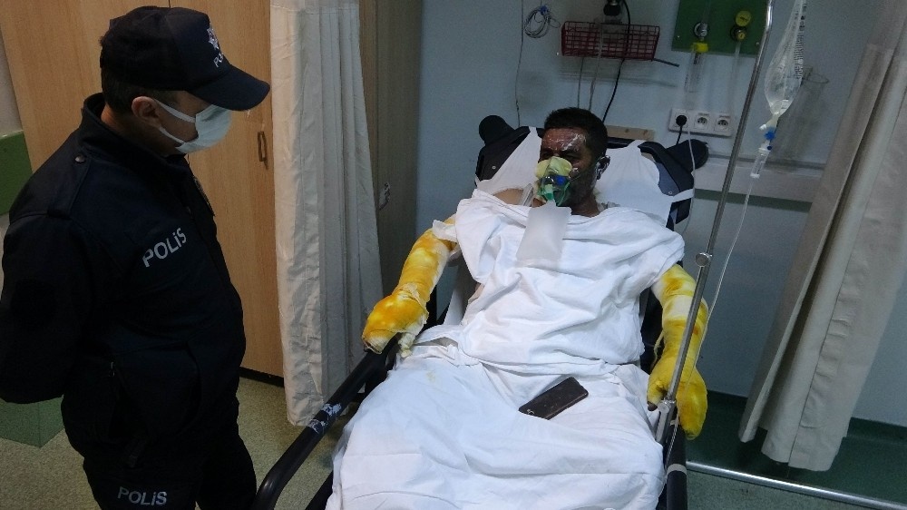 Yangında ailesini yanmaktan kurtardı, kendisi yanarak hastanelik oldu