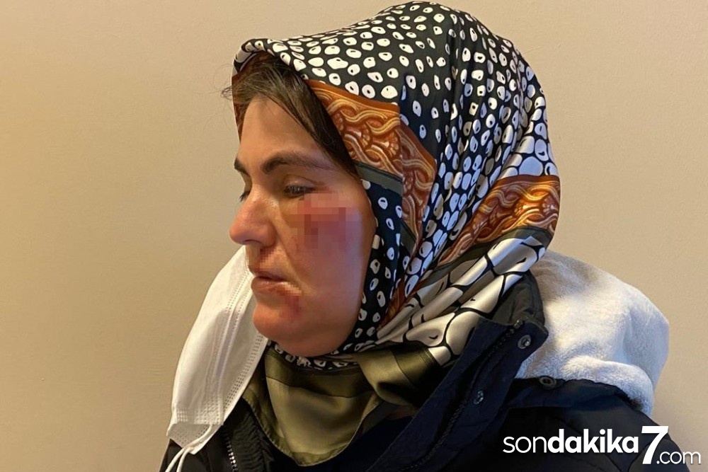 Maltepe’de korkunç olay: Sokak ortasında tanımadığı şahsın saldırısına uğradı