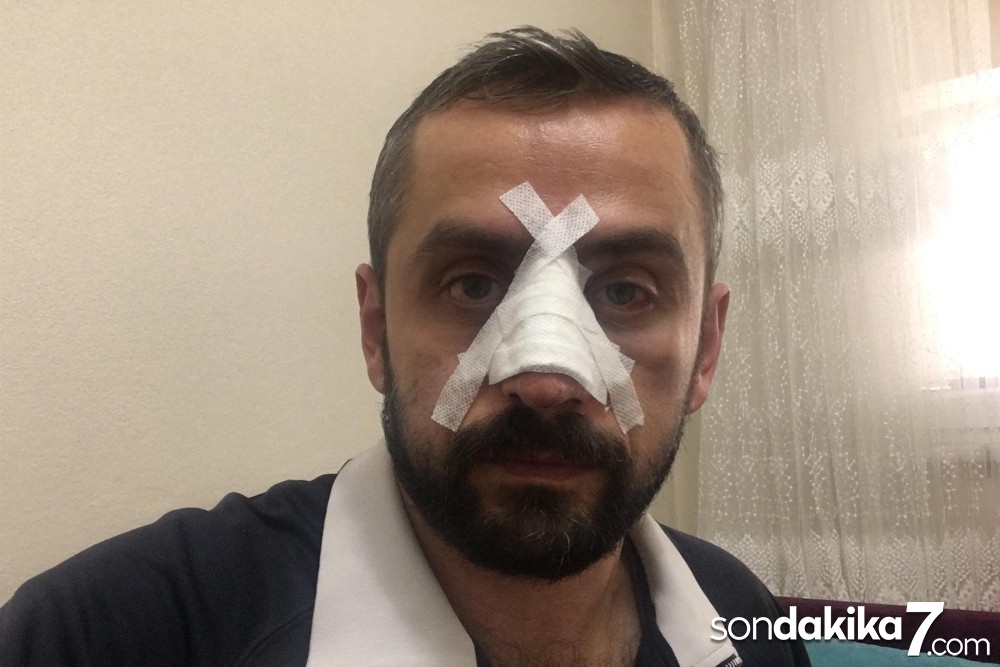 Gazetecilerin can güvenliği tehlikede