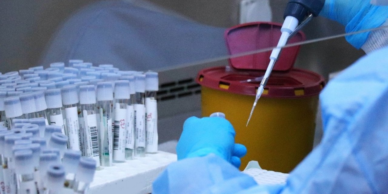 Samsun’da Günlük Test Kapasitesi İse 5 Binden 7 Bine Yükseltildi
