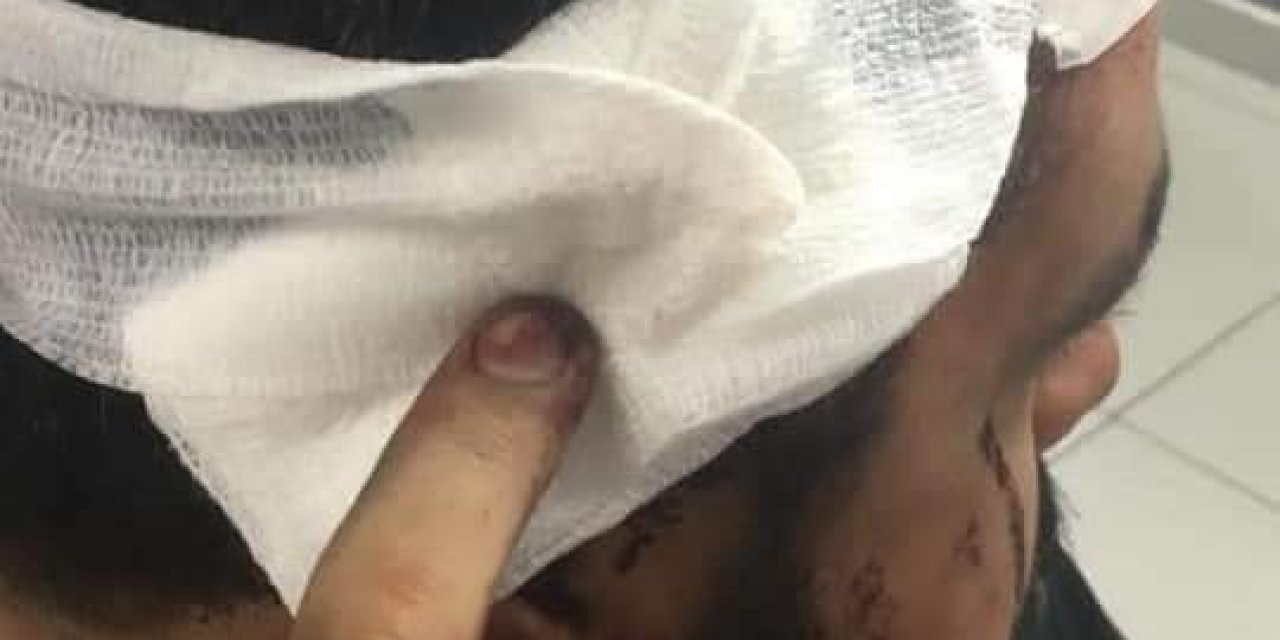Lübnan’da Şiddetlenen Protestolarda 220 Yaralı