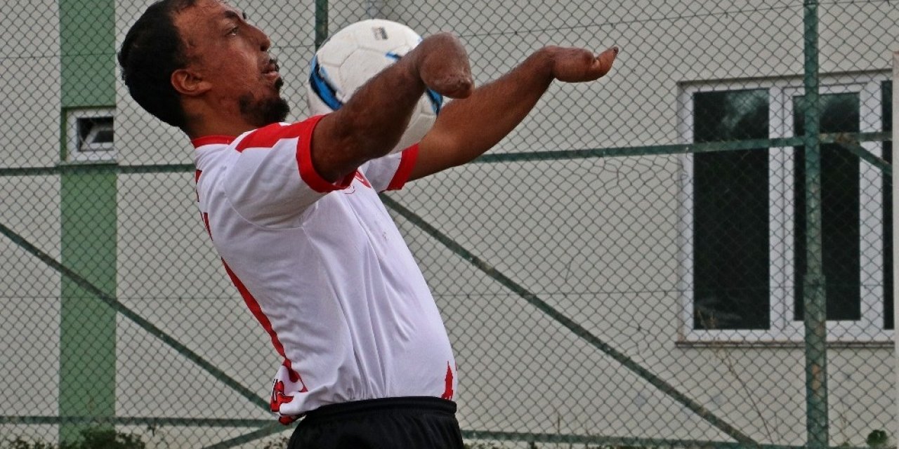 Yangında Ellerini Ve Yüzünü Kaybetti, Futbolda Gol Makinesi Oldu