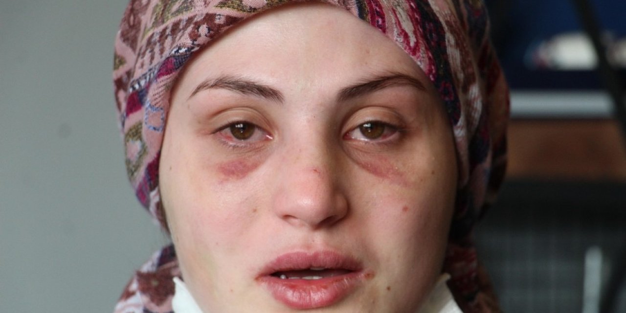 Kaçarak Evlendiği Eşi, Genç Kadına Kabusu Yaşattı