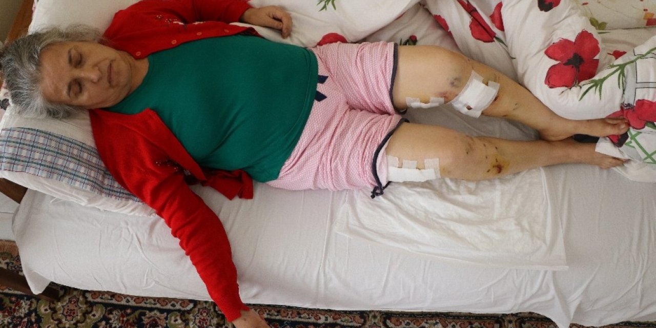 Sokak Köpeklerinin Saldırısına Uğrayan Yaşlı Kadın Ölümden Döndü