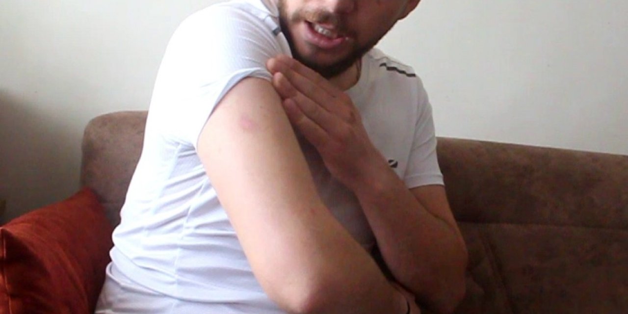 Patlayan Cep Telefonu Yaraladı