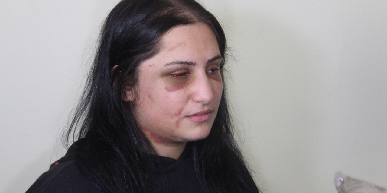 Eski Eşini Darp Eden Zanlının İddianamesi Tamamlandı