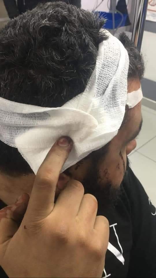 Lübnan’da Şiddetlenen Protestolarda 220 Yaralı