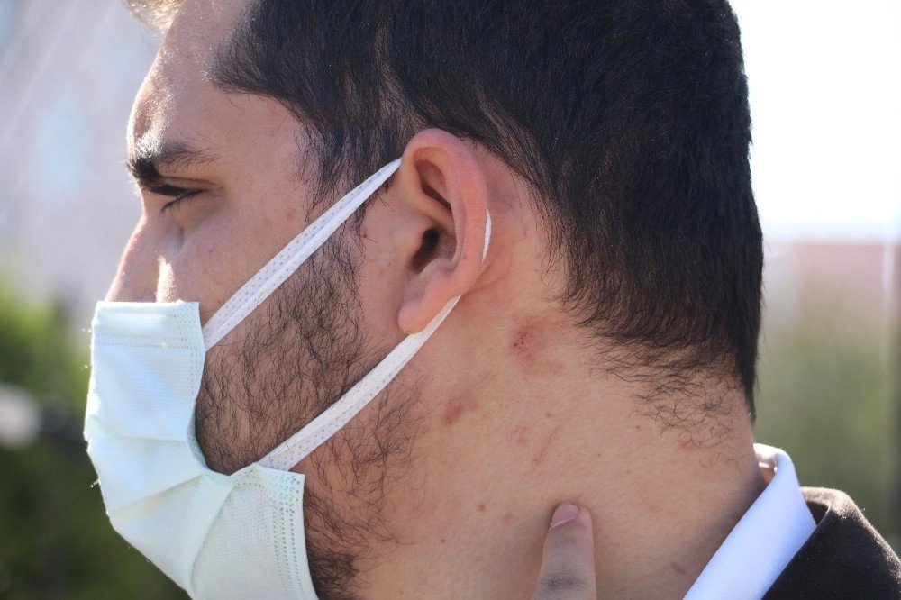 Yüzde 90 Engelli Adamı Öldüresiye Darp Ettiler