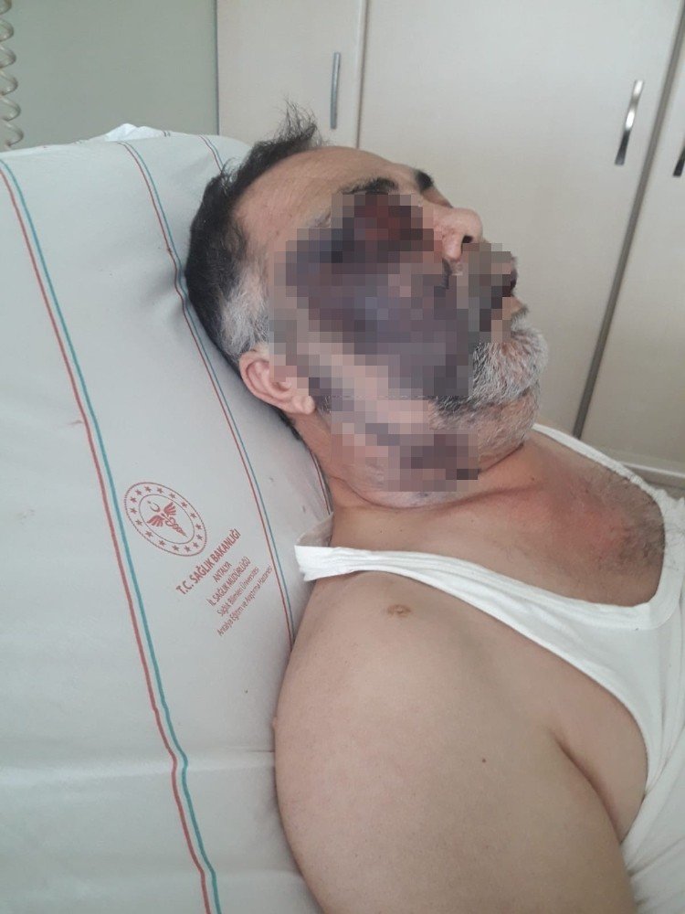 Engelli Adamın Darp Sonrası Ölümüne İkinci Tutuklama