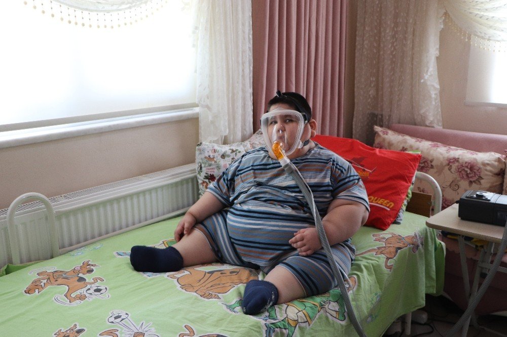 5 Yaşında 90 Kiloya Ulaşan Yağız Bebek, Arkadaşlarıyla Oynamak İstiyor