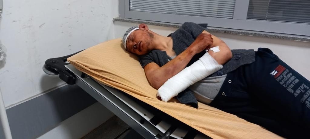 16 Yaşındaki Gence 5 Saatlik Dayak Olayında Savcı İddianameyi Hazırladı