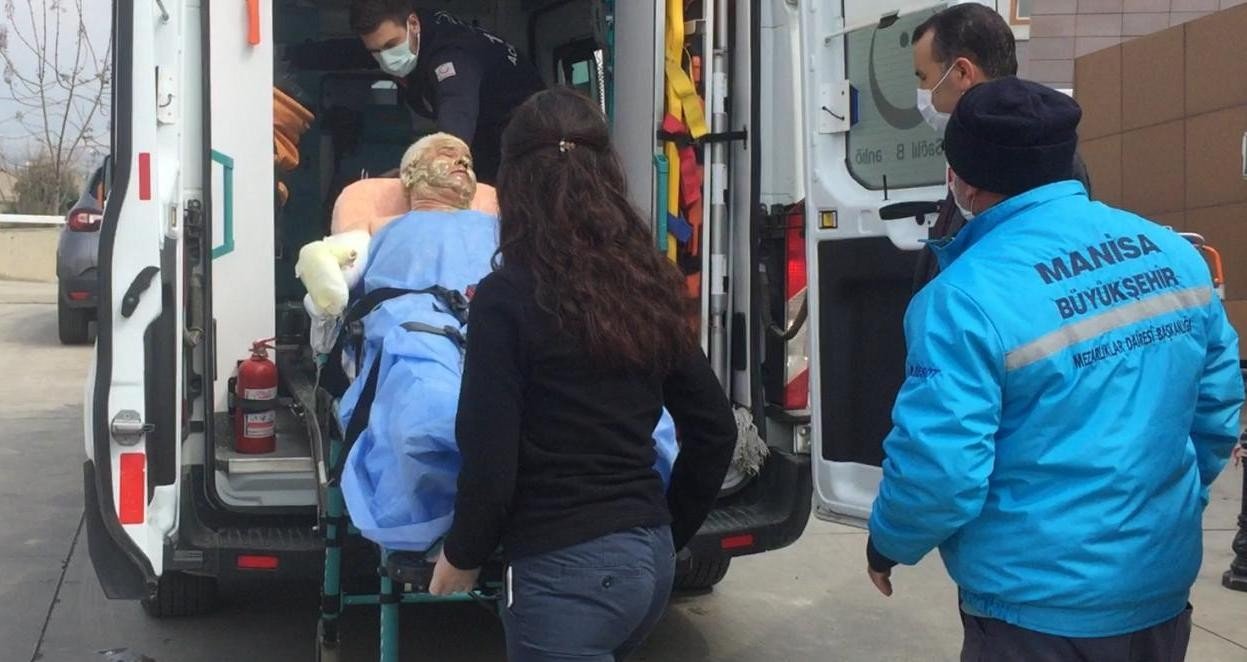 Üstüne Oturduğu Tiner Tenekesi Patladı, Alevler İçinde Kaldı