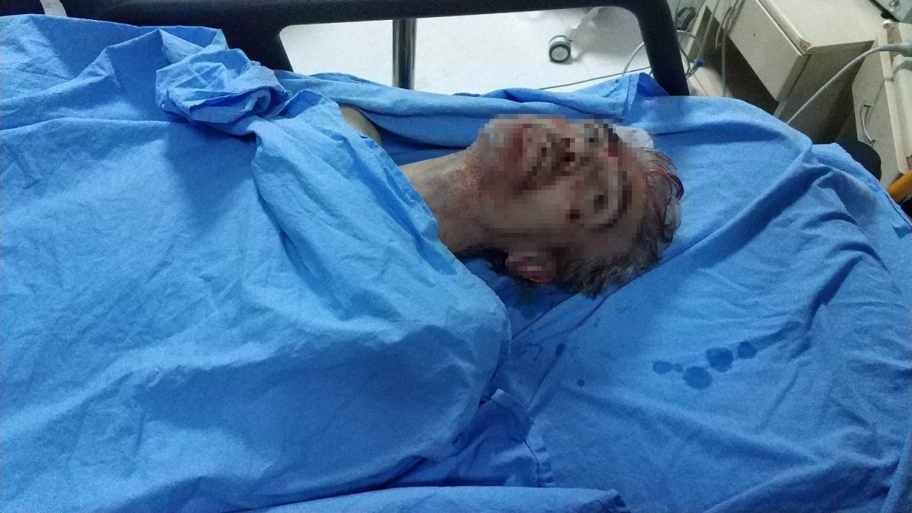 Samsun’daki Silahlı Saldırıda Ölü Sayısı 2’ye Çıktı